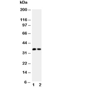 CALB1 / Calbindin Antibody - Western blot testing of Calbindin antibody (0.5ug/ml) and Lane 1: rat brain; 2: rat kidney lysate; Predicted size: 30KD; Observed size: ~37KD
