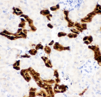 CALB1 / Calbindin Antibody - IHC-P: Calbindin antibody testing of mouse kidney tissue