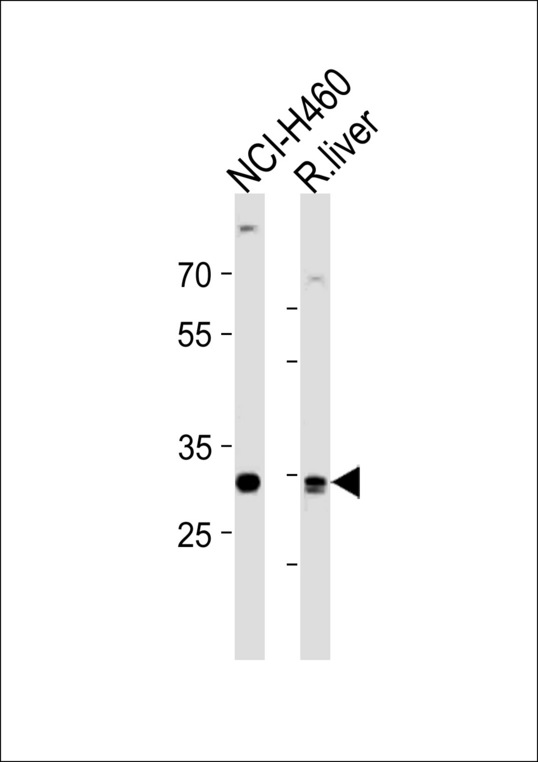 CALB1 / Calbindin Antibody - CALB1 Antibody western blot of NCI-H460 cell line and rat liver tissue lysates (35 ug/lane). The CALB1 antibody detected the CALB1 protein (arrow).