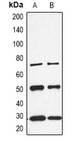 CALB1 / Calbindin Antibody - Western blot analysis of CALB1 expression in K562 (A); rat kidney (B) whole cell lysates.