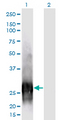 CALB1 / Calbindin Antibody - Western Blot analysis of CALB1 expression in transfected 293T cell line by CALB1 monoclonal antibody (M01), clone 1F6.Lane 1: CALB1 transfected lysate (Predicted MW: 30 KDa).Lane 2: Non-transfected lysate.