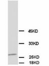 CALB1 / Calbindin Antibody -  This image was taken for the unconjugated form of this product. Other forms have not been tested.