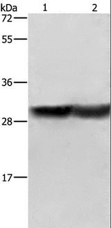 CALB1 / Calbindin Antibody - Western blot analysis of Human fetal brain and mouse kidney tissue, using CALB1 Polyclonal Antibody at dilution of 1:600.