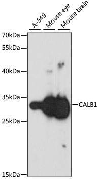CALB1 / Calbindin Antibody - Western blot analysis of extracts of various cell lines, using CALB1 antibody at 1:1000 dilution. The secondary antibody used was an HRP Goat Anti-Rabbit IgG (H+L) at 1:10000 dilution. Lysates were loaded 25ug per lane and 3% nonfat dry milk in TBST was used for blocking. An ECL Kit was used for detection and the exposure time was 30s.