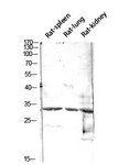 CALB1 / Calbindin Antibody - Western blot analysis of extracts from Rat spleen, Rat lung, and Rat kidney, using CALB1 Antibody.