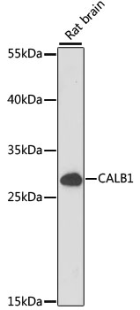 CALB1 / Calbindin Antibody - Western blot analysis of extracts of Rat brain, using CALB1 antibody at 1:1000 dilution. The secondary antibody used was an HRP Goat Anti-Rabbit IgG (H+L) at 1:10000 dilution. Lysates were loaded 25ug per lane and 3% nonfat dry milk in TBST was used for blocking. An ECL Kit was used for detection and the exposure time was 30s.