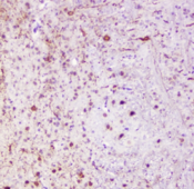 CALB1 / Calbindin Antibody - IHC staining of FFPE mouse brain with Calbindin antibody at 1ug/ml. HIER: boil tissue sections in pH6, 10mM citrate buffer, for 10-20 min followed by cooling at RT for 20 min.