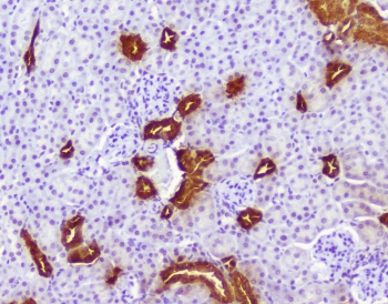CALB1 / Calbindin Antibody - IHC staining of FFPE mouse kidney with Calbindin antibody at 1ug/ml. HIER: boil tissue sections in pH6, 10mM citrate buffer, for 10-20 min followed by cooling at RT for 20 min.