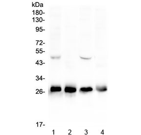 CALB1 / Calbindin Antibody - Western blot testing of 1) rat brain, 2) rat kidney, 3) mouse brain and 4) mouse kidney lysate with Calbindin antibody at 0.5ug/ml. Predicted molecular weight: ~30 kDa, routinely observed at 27-28 kDa.