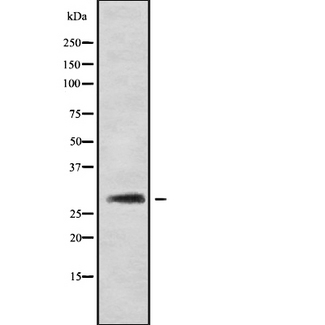 CALB1 / Calbindin Antibody - Western blot analysis of CALB1 using COLO205 whole cells lysates