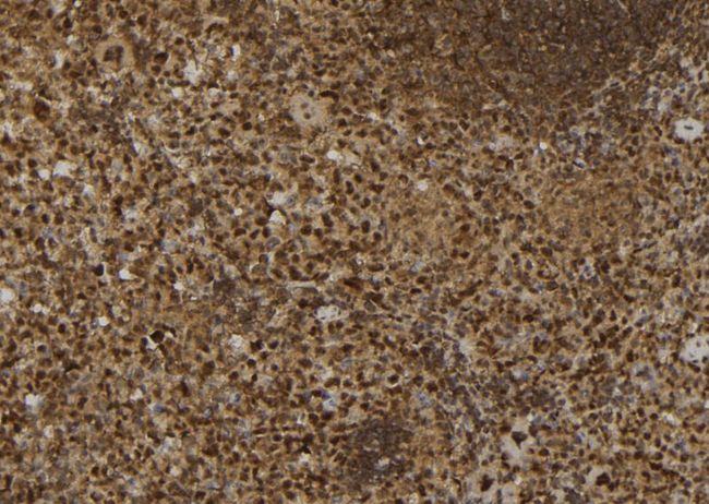 CALB1 / Calbindin Antibody - 1:100 staining mouse spleen tissue by IHC-P. The sample was formaldehyde fixed and a heat mediated antigen retrieval step in citrate buffer was performed. The sample was then blocked and incubated with the antibody for 1.5 hours at 22°C. An HRP conjugated goat anti-rabbit antibody was used as the secondary.