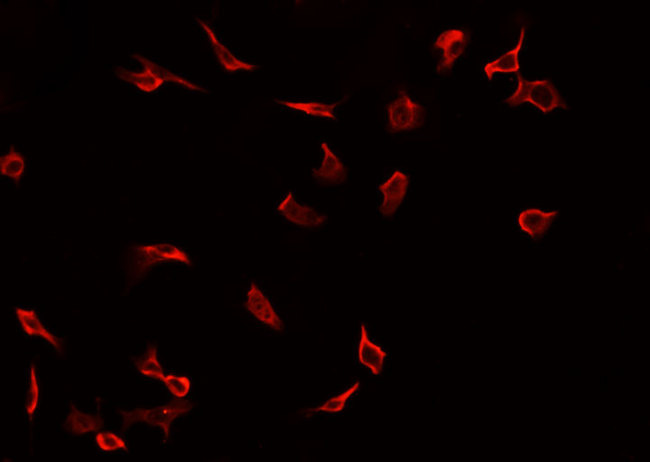 CALB1 / Calbindin Antibody - Staining HepG2 cells by IF/ICC. The samples were fixed with PFA and permeabilized in 0.1% Triton X-100, then blocked in 10% serum for 45 min at 25°C. The primary antibody was diluted at 1:200 and incubated with the sample for 1 hour at 37°C. An Alexa Fluor 594 conjugated goat anti-rabbit IgG (H+L) antibody, diluted at 1/600, was used as secondary antibody.