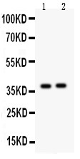 CALB2 / Calretinin Antibody - Calretinin antibody Western blot. All lanes: Anti Calretinin at 0.5 ug/ml. Lane 1: Rat Brain Tissue Lysate at 50 ug. Lane 2: Mouse Brain Tissue Lysate at 50 ug. Predicted band size: 31 kD. Observed band size: 38 kD.