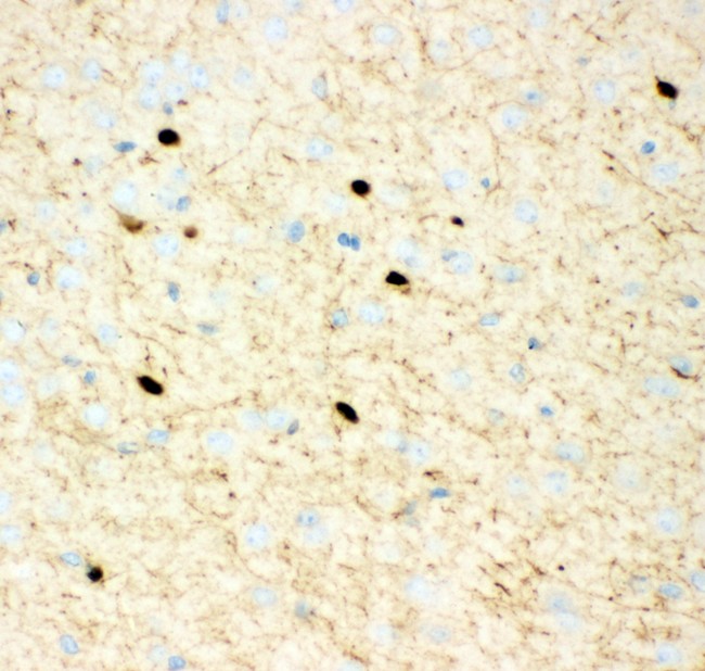 CALB2 / Calretinin Antibody - Calretinin antibody IHC-paraffin: Mouse Brain Tissue.