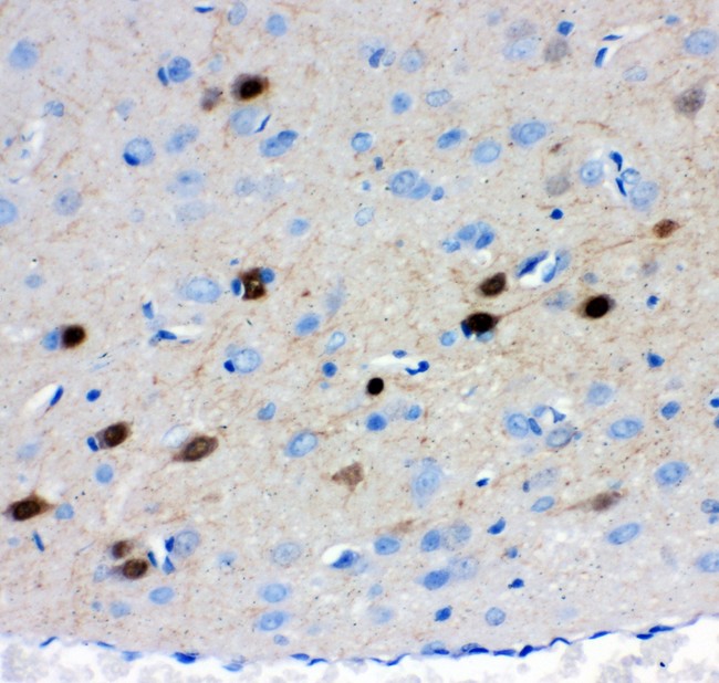 CALB2 / Calretinin Antibody - Calretinin antibody IHC-paraffin: Rat Brain Tissue.