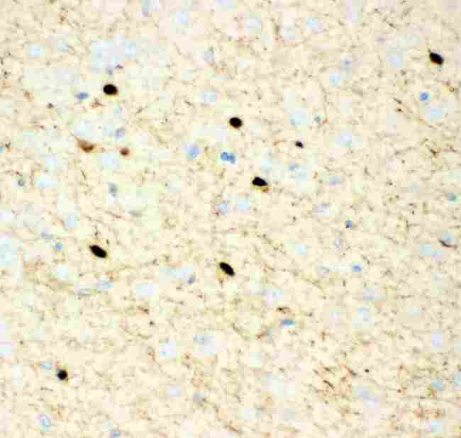 CALB2 / Calretinin Antibody - anti-Calretinin Picoband antibody IHC(P): Mouse Brain Tissue