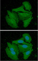 CALB2 / Calretinin Antibody - ICC/IF analysis of CALB2 in HeLa cells line, stained with DAPI (Blue) for nucleus staining and monoclonal anti-human CALB2 antibody (1:100) with goat anti-mouse IgG-Alexa fluor 488 conjugate (Green).