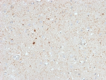 CALB2 / Calretinin Antibody - IHC testing of FFPE human cerebellum with Calretinin antibody (clone CALB2/2603). HIER: boil tissue sections in pH6, 10mM citrate buffer, for 10-20 min followed by cooling at RT for 20 min.
