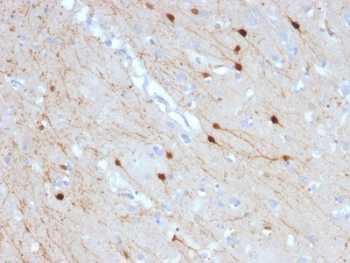 CALB2 / Calretinin Antibody - IHC testing of FFPE human cerebellum with Calbindin 2 antibody (clone CALB2/2685). HIER: boil tissue sections in pH6, 10mM citrate buffer, for 10-20 min followed by cooling at RT for 20 min.