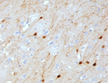 CALB2 / Calretinin Antibody - IHC testing of FFPE human cerebellum with Calretinin antibody (clone CLRT-1). HIER: boil tissue sections in pH6, 10mM citrate buffer, for 10-20 min followed by cooling at RT for 20 min.