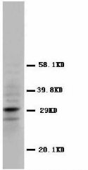 CALB2 / Calretinin Antibody -  This image was taken for the unconjugated form of this product. Other forms have not been tested.