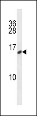 CALCA Antibody - CALCA/CT Antibody western blot of MDA-MB231 cell line lysates (35 ug/lane). The CALCA/CT antibody detected the CALCA/CT protein (arrow).