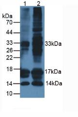 CALCA Antibody - Western Blot; Sample: Lane1: Rat Thyroid Tissue; Lane2: Human SW579 Cells.
