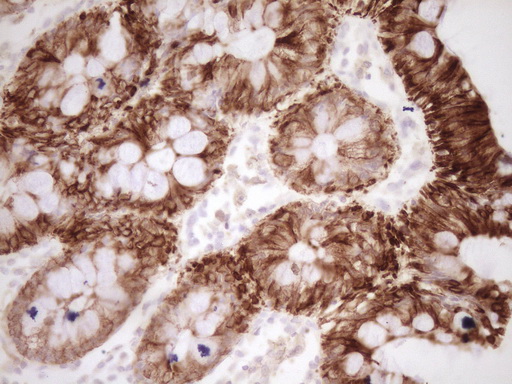 CALCA Antibody - IHC of paraffin-embedded Human colon tissue using anti-CALCA mouse monoclonal antibody. (Heat-induced epitope retrieval by Tris-EDTA, pH8.0).