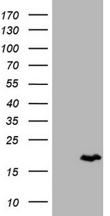 CALCA Antibody - HEK293T cells were transfected with the pCMV6-ENTRY control (Left lane) or pCMV6-ENTRY CALCA (Right lane) cDNA for 48 hrs and lysed. Equivalent amounts of cell lysates (5 ug per lane) were separated by SDS-PAGE and immunoblotted with anti-CALCA.