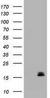 CALCA Antibody - HEK293T cells were transfected with the pCMV6-ENTRY control (Left lane) or pCMV6-ENTRY CALCA (Right lane) cDNA for 48 hrs and lysed. Equivalent amounts of cell lysates (5 ug per lane) were separated by SDS-PAGE and immunoblotted with anti-CALCA.