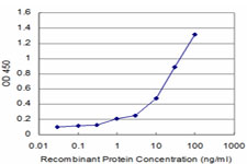 CALCA Antibody - Detection limit for recombinant GST tagged CALCA is approximately 1 ng/ml as a capture antibody.