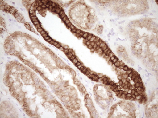 CALCA Antibody - IHC of paraffin-embedded Human Kidney tissue using anti-CALCA mouse monoclonal antibody. (Heat-induced epitope retrieval by Tris-EDTA, pH8.0).