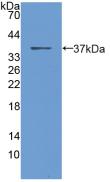 CALCA Antibody - Western Blot; Sample: Recombinant PCT, Human.