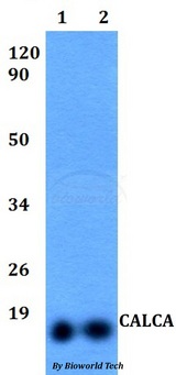 CALCA Antibody - Western blot of CALCA antibody at 1:500 dilution. Lane 1: HeLa whole cell lysate. Lane 2: H9C2 whole cell lysate.