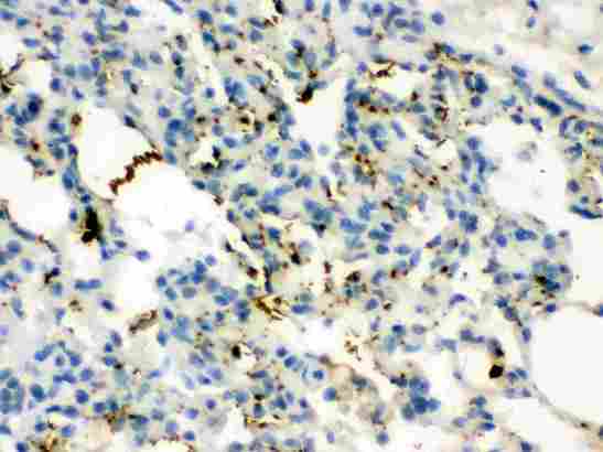 CALCA Antibody - Calcitonin was detected in paraffin-embedded sections of rat lung tissues using rabbit anti- Calcitonin Antigen Affinity purified polyclonal antibody