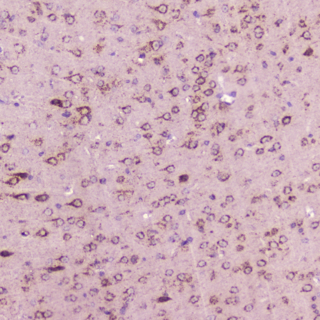 CALCA Antibody - IHC analysis of Calcitonin using anti-Calcitonin antibody. Calcitonin was detected in paraffin-embedded section of mouse brain tissue . Heat mediated antigen retrieval was performed in citrate buffer (pH6, epitope retrieval solution) for 20 mins. The tissue section was blocked with 10% goat serum. The tissue section was then incubated with 2?g/ml rabbit anti-Calcitonin Antibody overnight at 4?C. Biotinylated goat anti-rabbit IgG was used as secondary antibody and incubated for 30 minutes at 37?C. The tissue section was developed using Strepavidin-Biotin-Complex (SABC) with DAB as the chromogen.