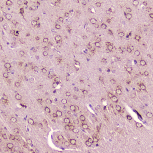 CALCA Antibody - IHC analysis of Calcitonin using anti-Calcitonin antibody. Calcitonin was detected in paraffin-embedded section of rat brain tissue . Heat mediated antigen retrieval was performed in citrate buffer (pH6, epitope retrieval solution) for 20 mins. The tissue section was blocked with 10% goat serum. The tissue section was then incubated with 2?g/ml rabbit anti-Calcitonin Antibody overnight at 4?C. Biotinylated goat anti-rabbit IgG was used as secondary antibody and incubated for 30 minutes at 37?C. The tissue section was developed using Strepavidin-Biotin-Complex (SABC) with DAB as the chromogen.