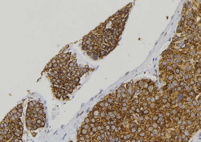 CALCA Antibody - 1:100 staining human pancreas tissue by IHC-P. The sample was formaldehyde fixed and a heat mediated antigen retrieval step in citrate buffer was performed. The sample was then blocked and incubated with the antibody for 1.5 hours at 22°C. An HRP conjugated goat anti-rabbit antibody was used as the secondary.