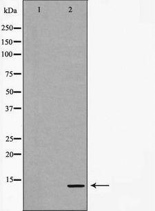 CALCA Antibody - Western blot analysis of extracts of mouse lung using CALCA antibody. The lane on the left is treated with the antigen-specific peptide.
