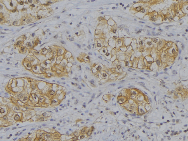CALCA Antibody - 1:100 staining human uterus tissue by IHC-P. The sample was formaldehyde fixed and a heat mediated antigen retrieval step in citrate buffer was performed. The sample was then blocked and incubated with the antibody for 1.5 hours at 22°C. An HRP conjugated goat anti-rabbit antibody was used as the secondary.