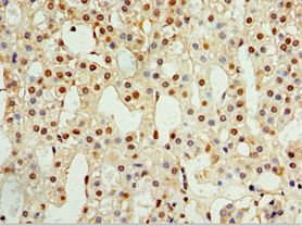 CALCB Antibody - Immunohistochemistry of paraffin-embedded human adrenal gland using antibody at 1:100 dilution.