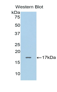 CALCB Antibody - Western blot of recombinant CALCB.  This image was taken for the unconjugated form of this product. Other forms have not been tested.