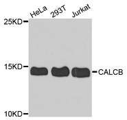 CALCB Antibody - Western blot analysis of extract of various cells.