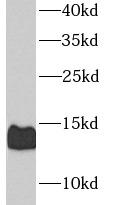 CALCB Antibody - Jurkat cells were subjected to SDS PAGE followed by western blot with CGRP-II antibody at dilution of 1:1000