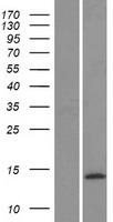 CALCB Protein - Western validation with an anti-DDK antibody * L: Control HEK293 lysate R: Over-expression lysate