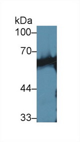 Calcineurin Antibody - Western Blot; Sample: Mouse Skeletal muscle lysate; Primary Ab: 1µg/ml Rabbit Anti-Human CaN Antibody Second Ab: 0.2µg/mL HRP-Linked Caprine Anti-Rabbit IgG Polyclonal Antibody