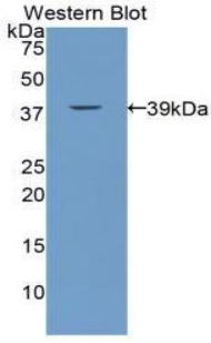 Calcitonin Antibody - Western blot of recombinant CGRP / Calcitonin.  This image was taken for the unconjugated form of this product. Other forms have not been tested.