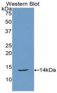 Calcitonin Antibody - Western blot of recombinant CGRP / Calcitonin.  This image was taken for the unconjugated form of this product. Other forms have not been tested.