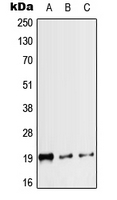 Calcitonin Antibody - Western blot analysis of Calcitonin expression in HEK293T (A); mouse heart (B); rat heart (C) whole cell lysates.