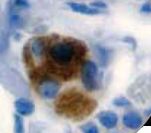 Calcitonin Antibody - IHC of Calcitonin on FFPE Thyroid tissue. This image was taken for the unmodified form of this product. Other forms have not been tested.